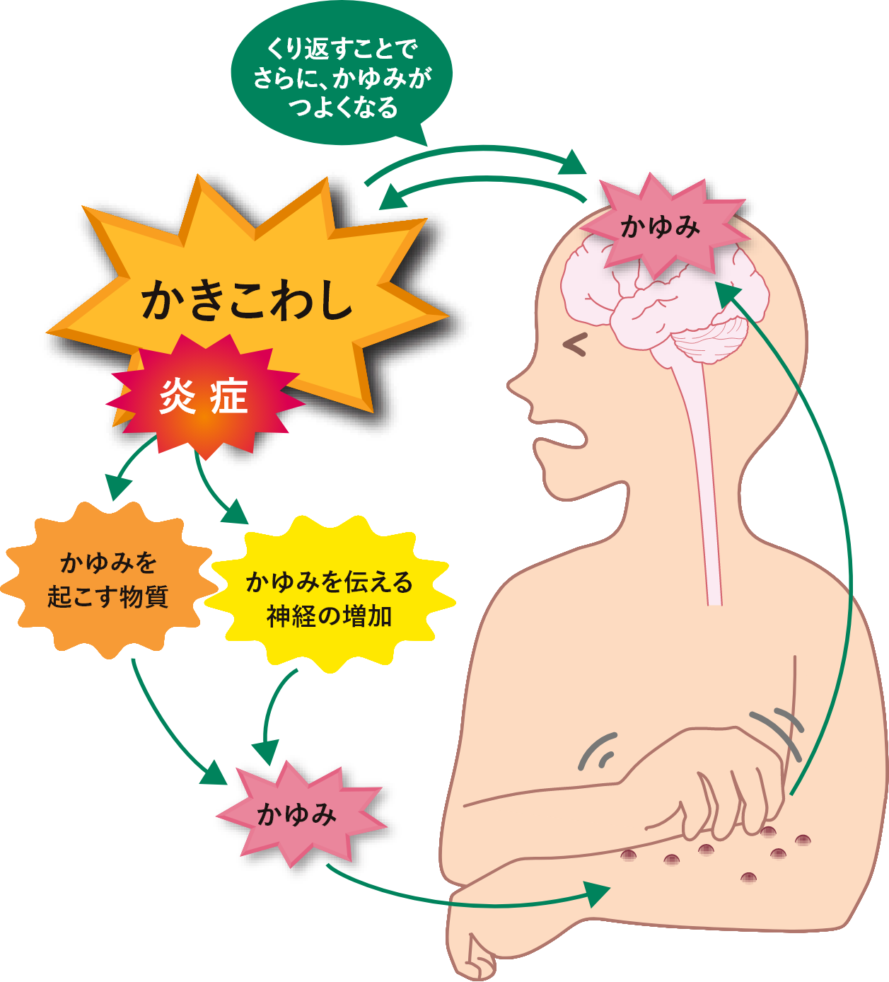 結節性痒疹 | お肌のクリニック